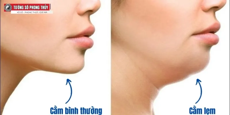 Cằm lẹm tướng số là gì và đặc điểm nhân tướng học